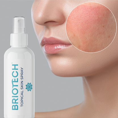 Topical Skin Spray