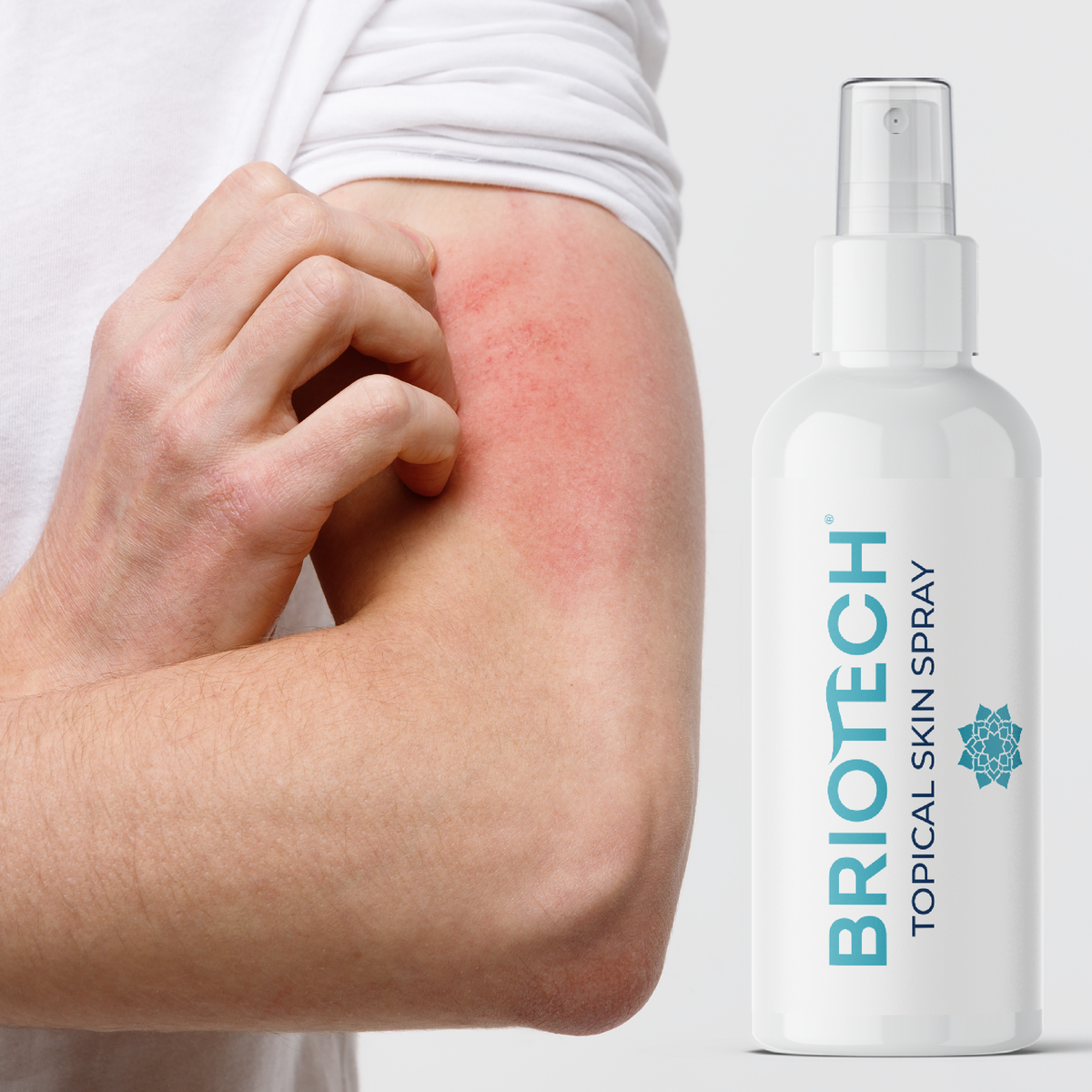 Topical Skin Spray