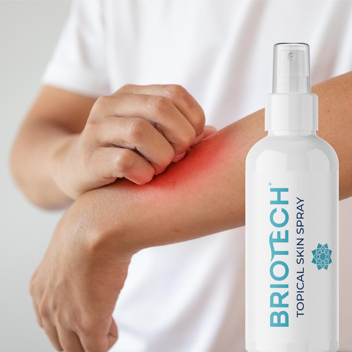 Topical Skin Spray