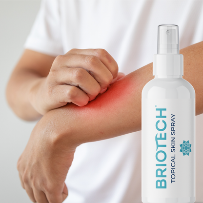 Topical Skin Spray