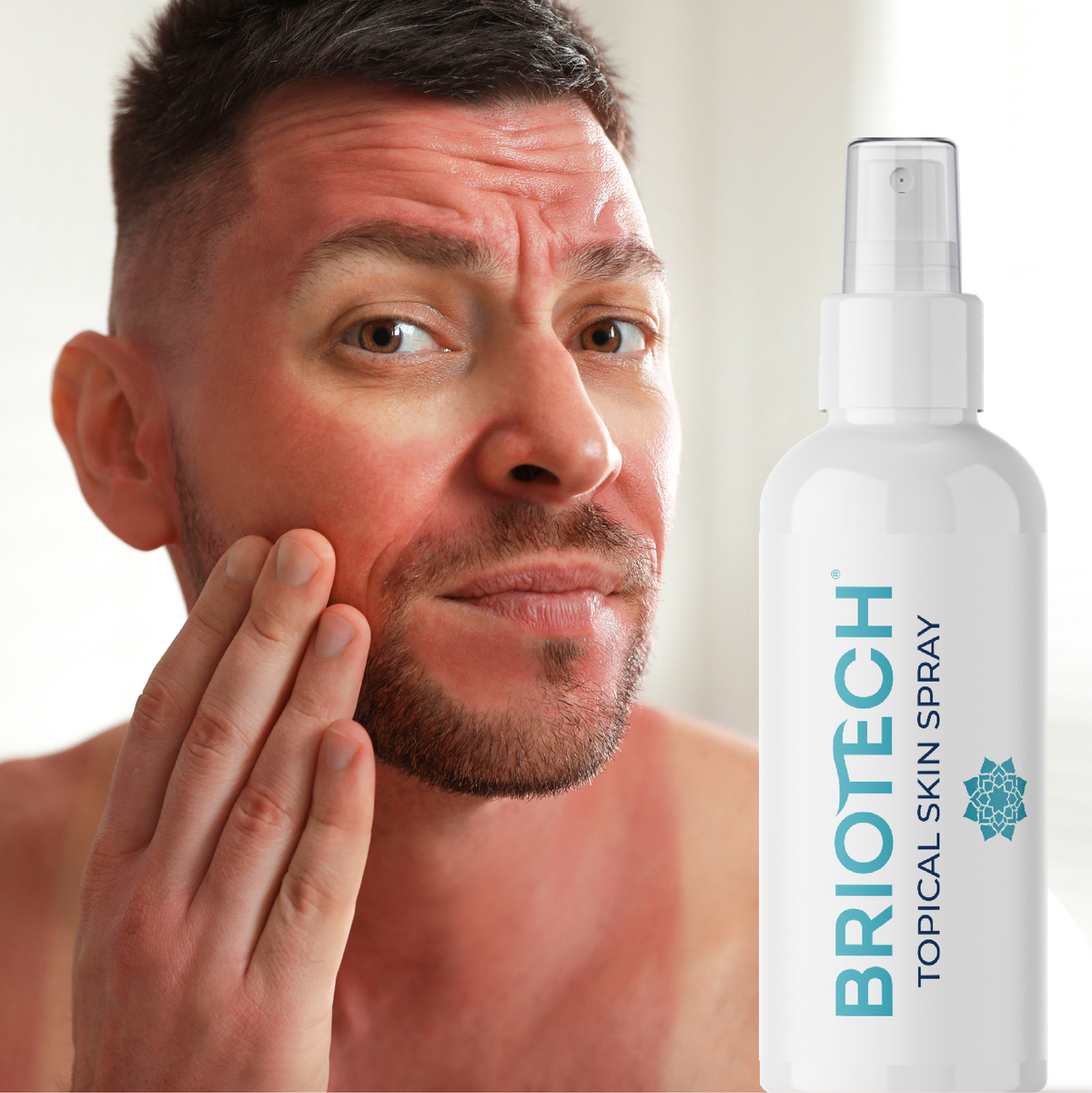 Topical Skin Spray