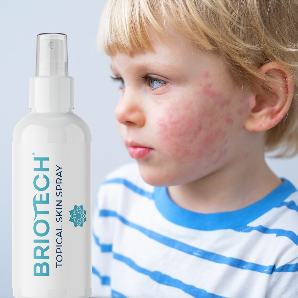 Topical Skin Spray