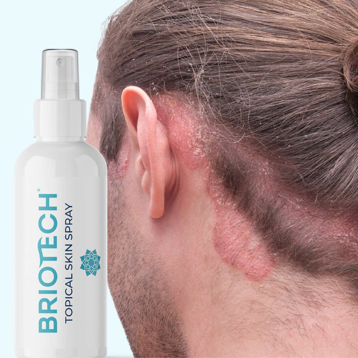 Topical Skin Spray