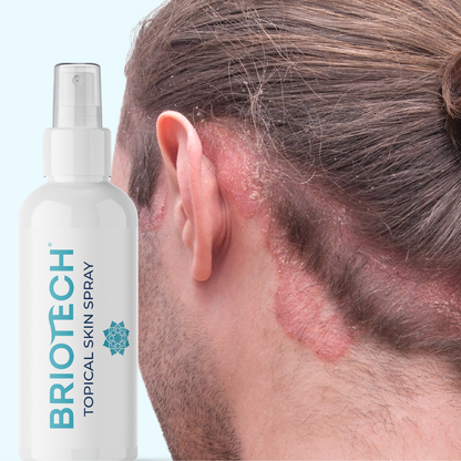 Topical Skin Spray
